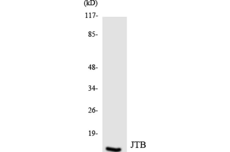 Western Blot - Anti-JTB Antibody (R12-2942) - Antibodies.com