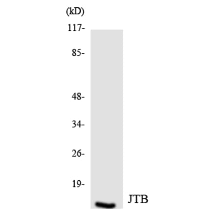 Western Blot - Anti-JTB Antibody (R12-2942) - Antibodies.com