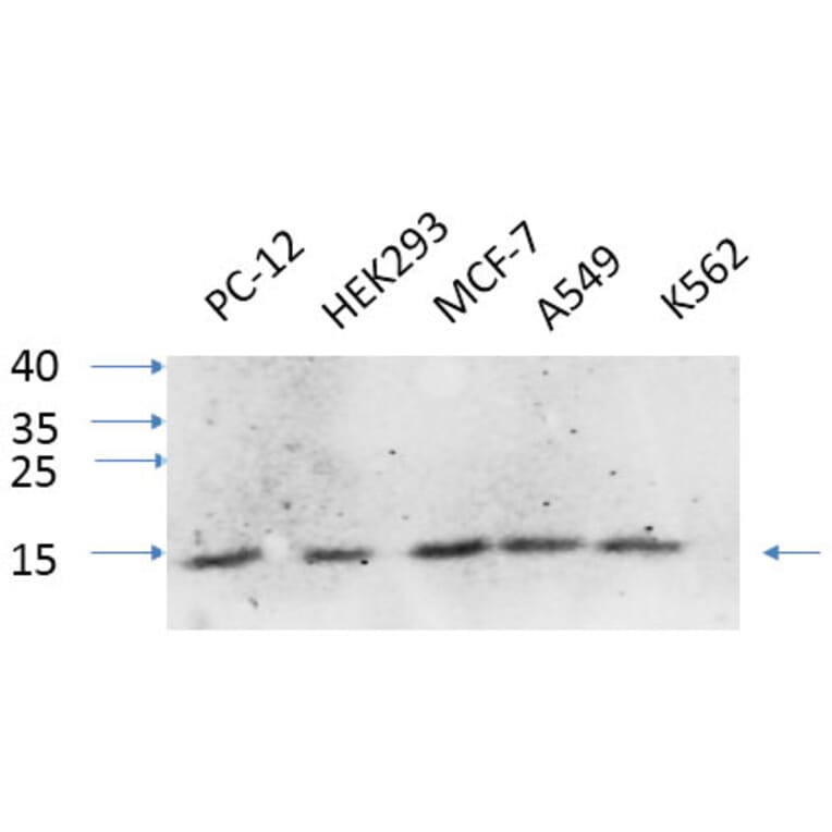 Western Blot - Anti-IL8 Antibody (C30028) - Antibodies.com