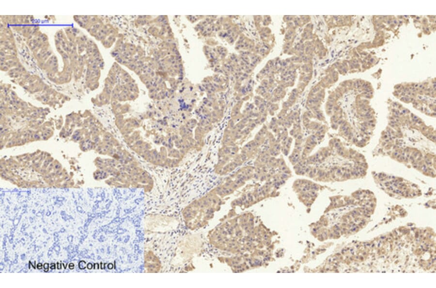Immunohistochemistry - Anti-IL8 Antibody (C30028) - Antibodies.com