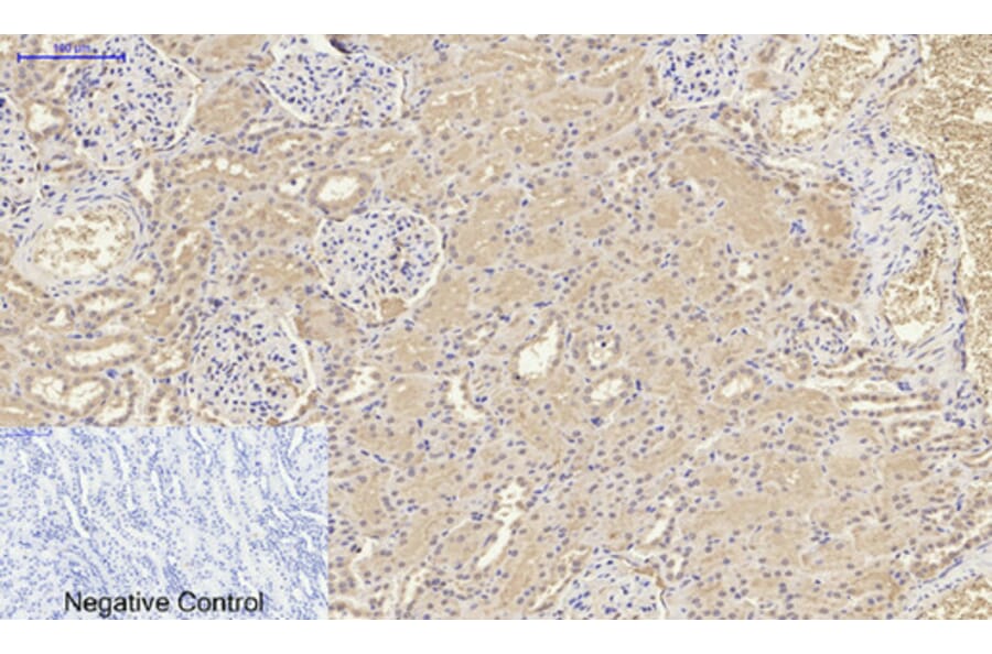 Immunohistochemistry - Anti-IL8 Antibody (C30028) - Antibodies.com
