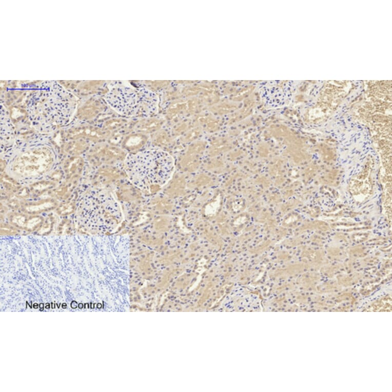 Immunohistochemistry - Anti-IL8 Antibody (C30028) - Antibodies.com