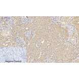 Immunohistochemistry - Anti-IL8 Antibody (C30028) - Antibodies.com