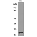 Western Blot - Anti-IL6 Antibody (C30006) - Antibodies.com