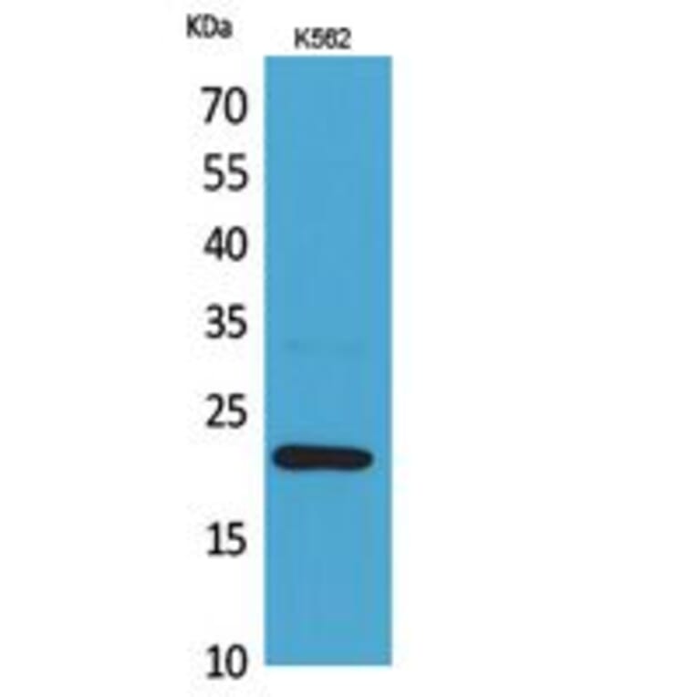 Western Blot - Anti-IL6 Antibody (C30006) - Antibodies.com