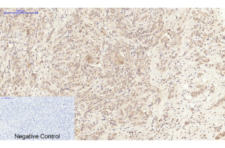 Immunohistochemistry - Anti-IL6 Antibody (C30006) - Antibodies.com