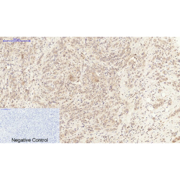 Immunohistochemistry - Anti-IL6 Antibody (C30006) - Antibodies.com
