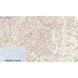 Immunohistochemistry - Anti-IL6 Antibody (C30006) - Antibodies.com
