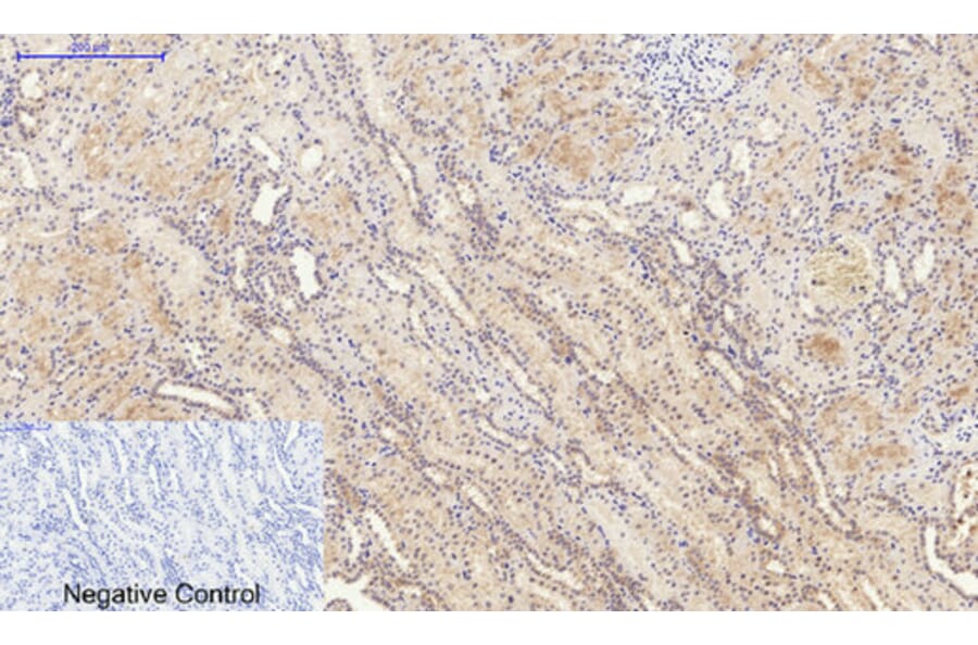 Immunohistochemistry - Anti-IL6 Antibody (C30006) - Antibodies.com