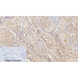Immunohistochemistry - Anti-IL6 Antibody (C30006) - Antibodies.com