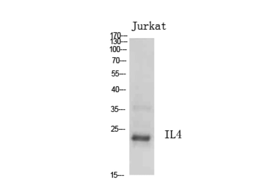 Western Blot - Anti-IL4 Antibody (C30015) - Antibodies.com