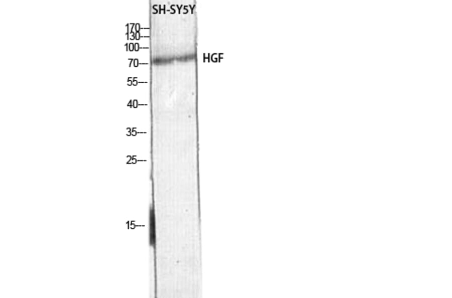 Western Blot - Anti-HGF Antibody (C30161) - Antibodies.com