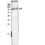 Western Blot - Anti-HGF Antibody (C30161) - Antibodies.com