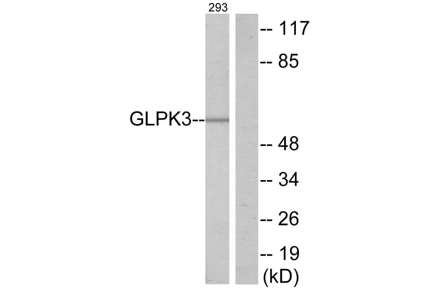 Western Blot - Anti-GK3 Antibody (C11031) - Antibodies.com