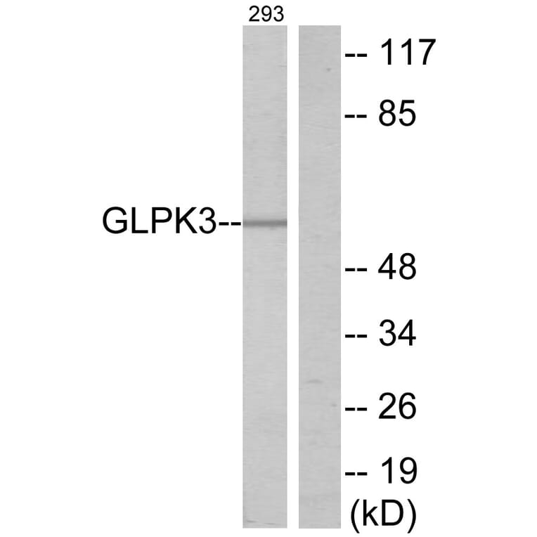 Western Blot - Anti-GK3 Antibody (C11031) - Antibodies.com