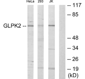 Western Blot - Anti-GK2 Antibody (C11032) - Antibodies.com