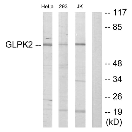 Western Blot - Anti-GK2 Antibody (C11032) - Antibodies.com