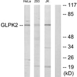 Western Blot - Anti-GK2 Antibody (C11032) - Antibodies.com