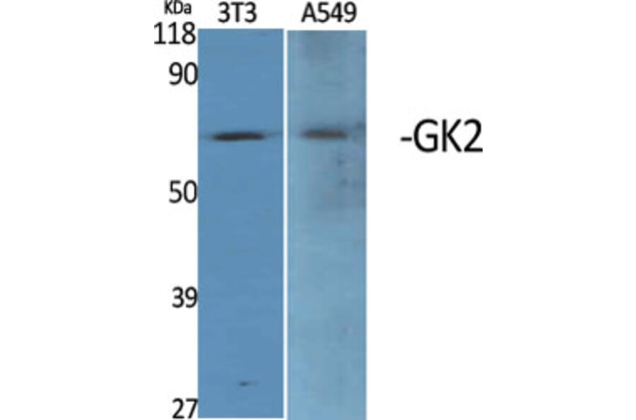 Western Blot - Anti-GK2 Antibody (C11032) - Antibodies.com