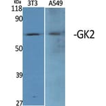 Western Blot - Anti-GK2 Antibody (C11032) - Antibodies.com