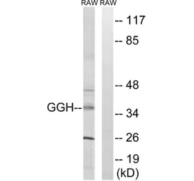 Western Blot - Anti-GGH Antibody (C15866) - Antibodies.com