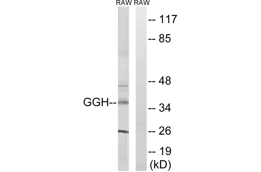 Western Blot - Anti-GGH Antibody (C15866) - Antibodies.com