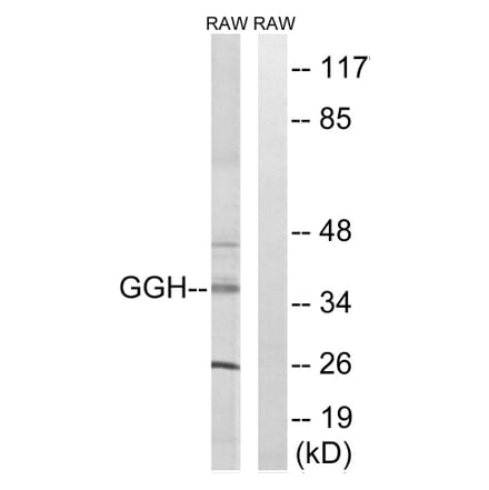 Western Blot - Anti-GGH Antibody (C15866) - Antibodies.com