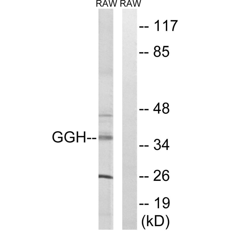 Western Blot - Anti-GGH Antibody (C15866) - Antibodies.com