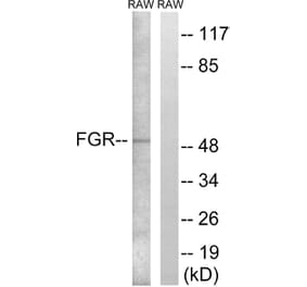Western Blot - Anti-FGR Antibody (B8105) - Antibodies.com