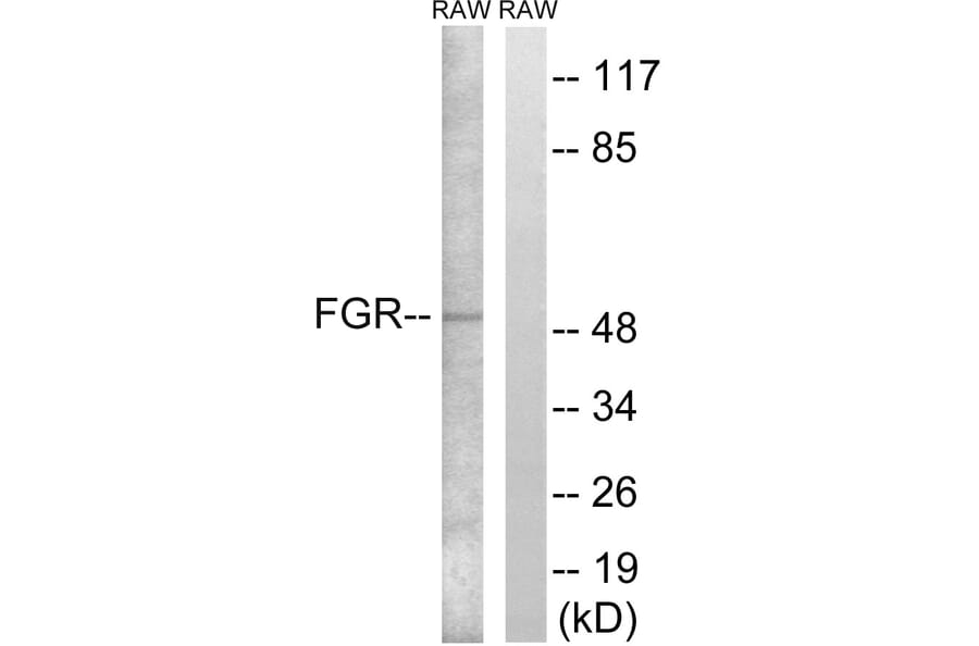 Western Blot - Anti-FGR Antibody (B8105) - Antibodies.com