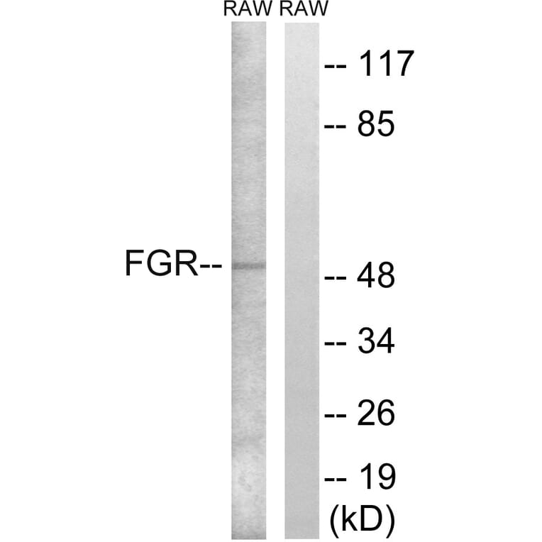Western Blot - Anti-FGR Antibody (B8105) - Antibodies.com