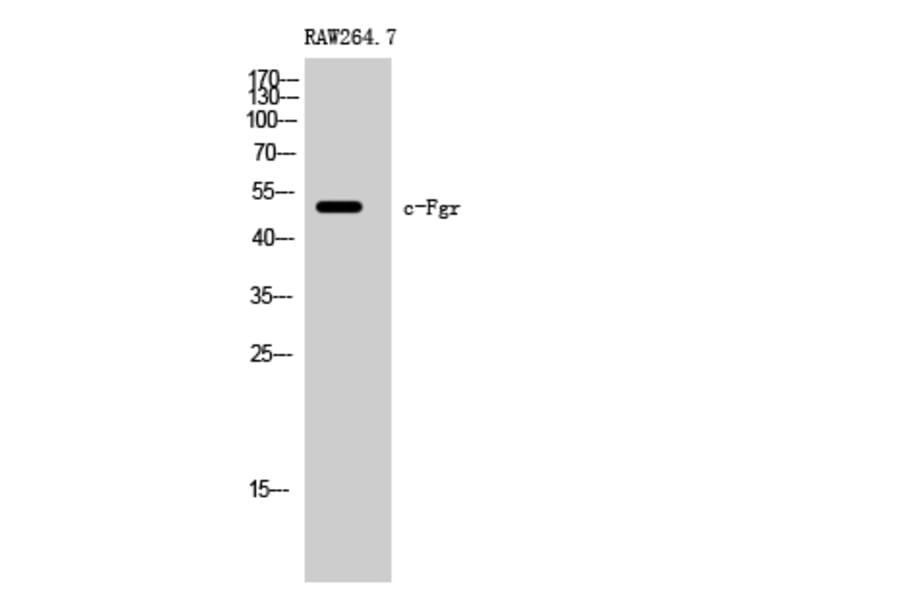 Western Blot - Anti-FGR Antibody (B8105) - Antibodies.com