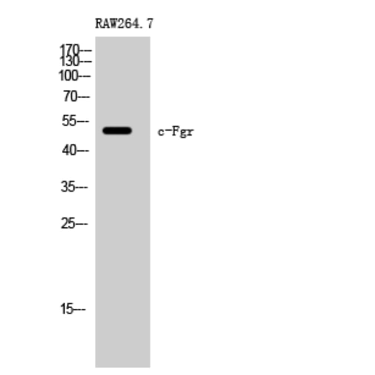 Western Blot - Anti-FGR Antibody (B8105) - Antibodies.com