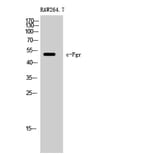Western Blot - Anti-FGR Antibody (B8105) - Antibodies.com