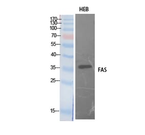 Western Blot - Anti-FAS Antibody (C30400) - Antibodies.com