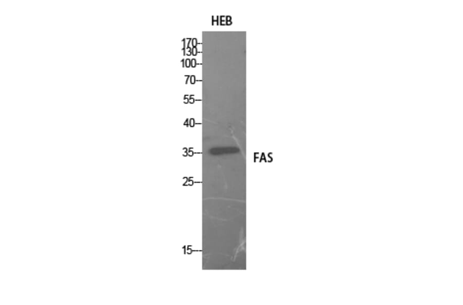 Western Blot - Anti-FAS Antibody (C30400) - Antibodies.com