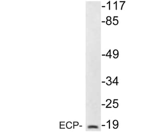 Western Blot - Anti-ECP Antibody (R12-2123) - Antibodies.com