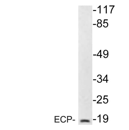 Western Blot - Anti-ECP Antibody (R12-2123) - Antibodies.com