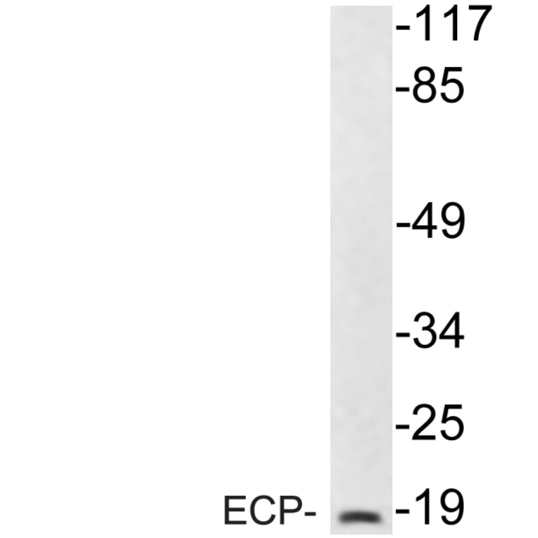 Western Blot - Anti-ECP Antibody (R12-2123) - Antibodies.com