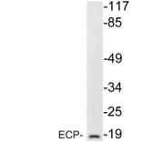 Western Blot - Anti-ECP Antibody (R12-2123) - Antibodies.com