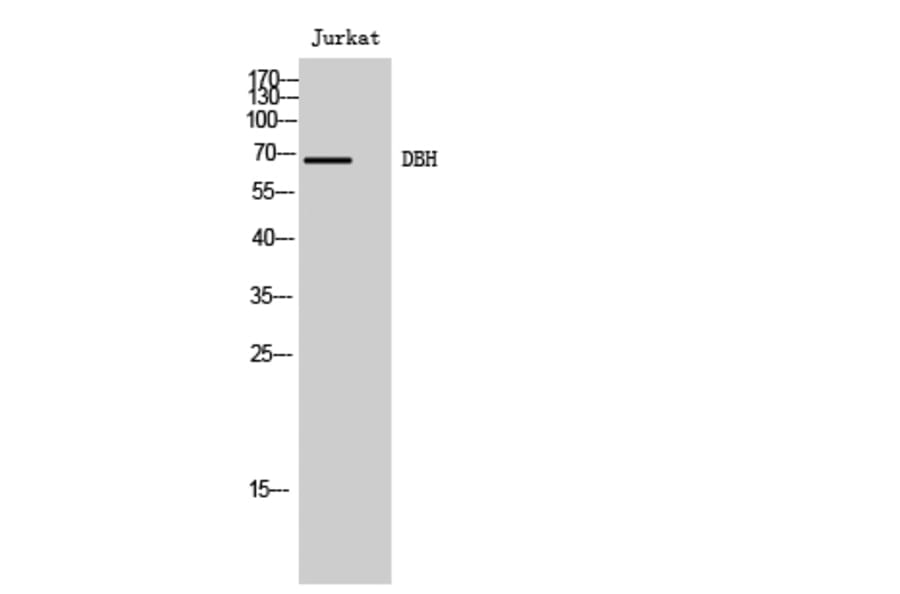 Western Blot - Anti-DBH Antibody (C15500) - Antibodies.com