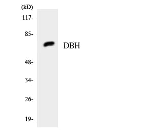 Western Blot - Anti-DBH Antibody (R12-2688) - Antibodies.com