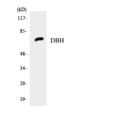 Western Blot - Anti-DBH Antibody (R12-2688) - Antibodies.com