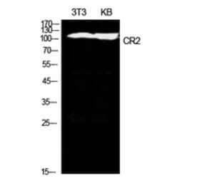 Western Blot - Anti-CR2 Antibody (C30335) - Antibodies.com
