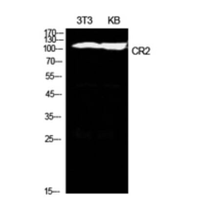 Western Blot - Anti-CR2 Antibody (C30335) - Antibodies.com
