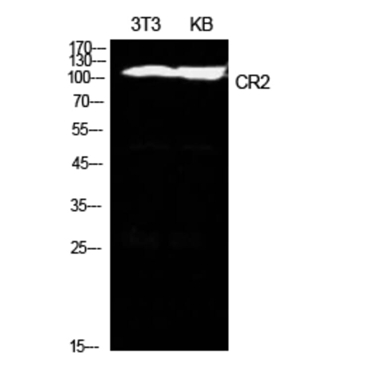 Western Blot - Anti-CR2 Antibody (C30335) - Antibodies.com