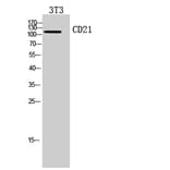 Western Blot - Anti-CR2 Antibody (C30335) - Antibodies.com