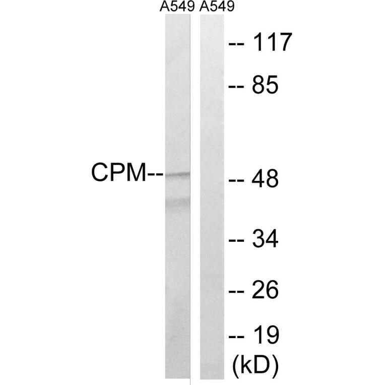 Western Blot - Anti-CPM Antibody (C14962) - Antibodies.com