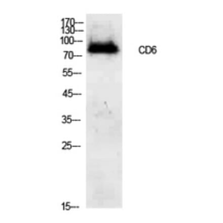 Western Blot - Anti-CD6 Antibody (C30323) - Antibodies.com