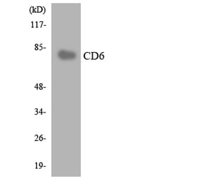 Western Blot - Anti-CD6 Antibody (R12-2590) - Antibodies.com